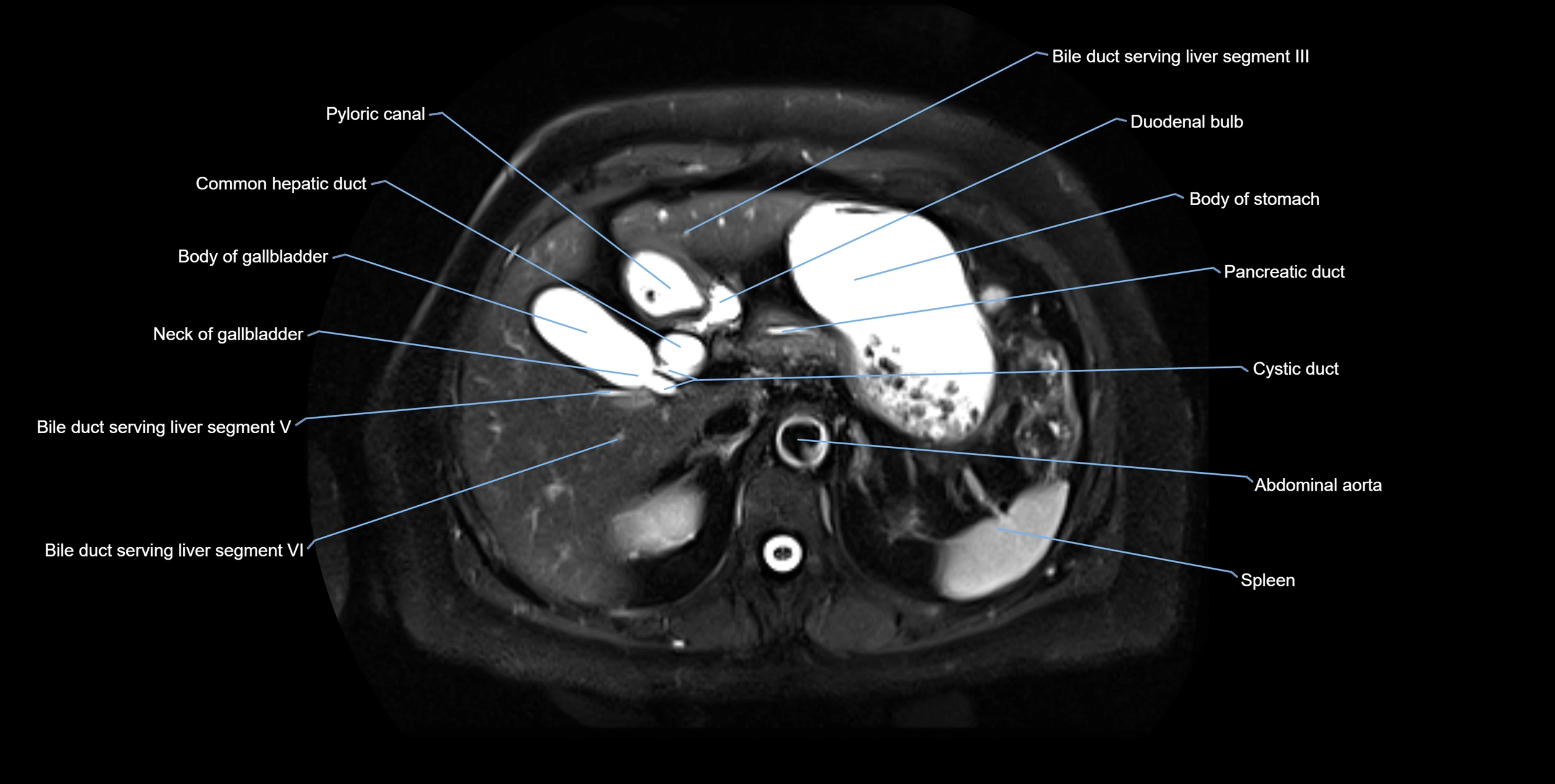 MRI MRCP axial cross sectional anatomy 3T radiology  image-img-10001-00018.webp